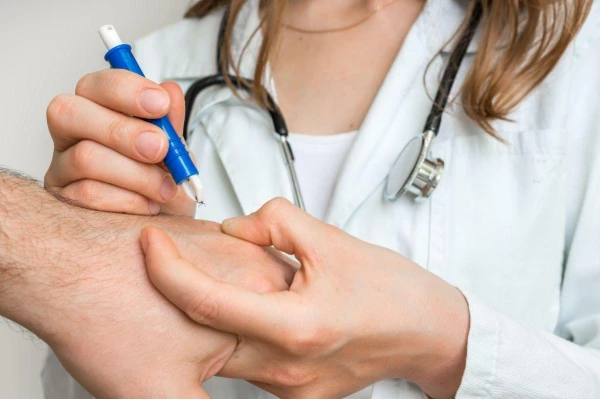Borelioza – objawy, diagnoza, leczenie i profilaktyka