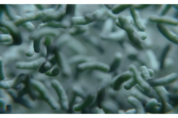 Helicobacter pylori – czym grozi zarażenie bakterią?