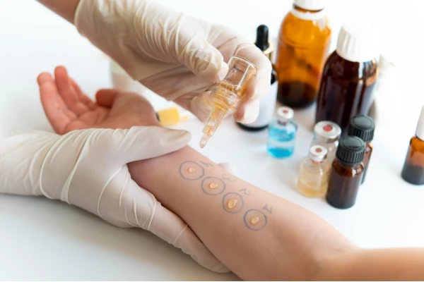 Testy alergiczne - punktowe, z krwi czy molekularne? Jaką diagnostykę wybrać?