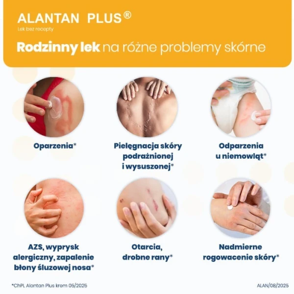 Alantan Plus (20mg+50mg)/g, krem, 100g 2