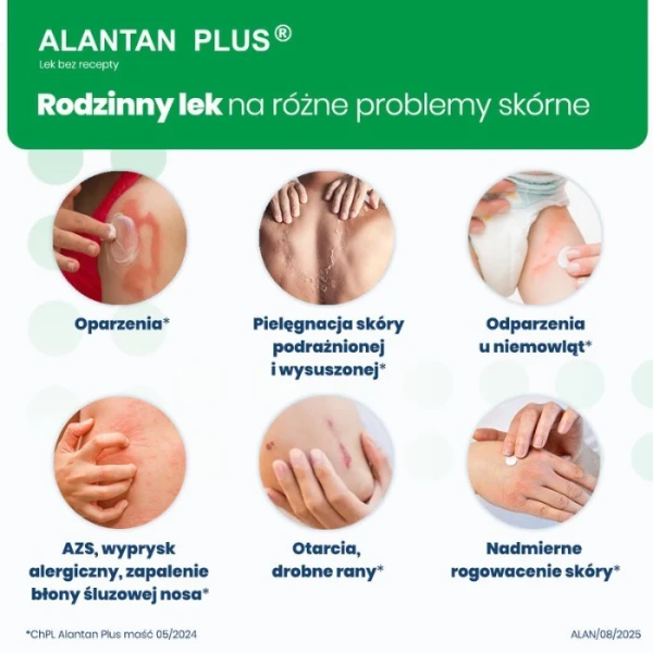 Alantan Plus (20mg+50mg)/g, maść, 100g 2
