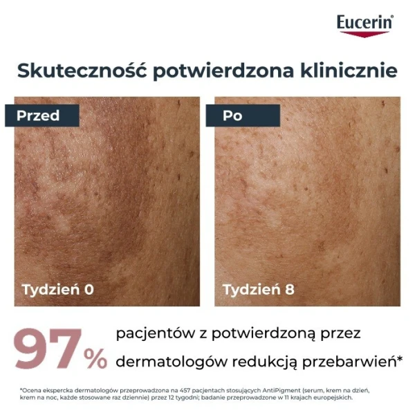 Eucerin Anti-Pigment, krem na dzień, SPF 30, 50ml 5