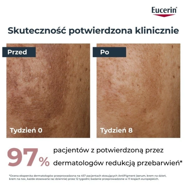 Eucerin Anti-Pigment, serum o podwójnym działaniu, 30ml 7