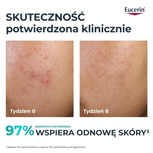 Eucerin DermoPure Clinical, kuracja złuszczająco-wygładzająca Peeling 10, z kwasem glikolowym i salicylowym, 40ml 6